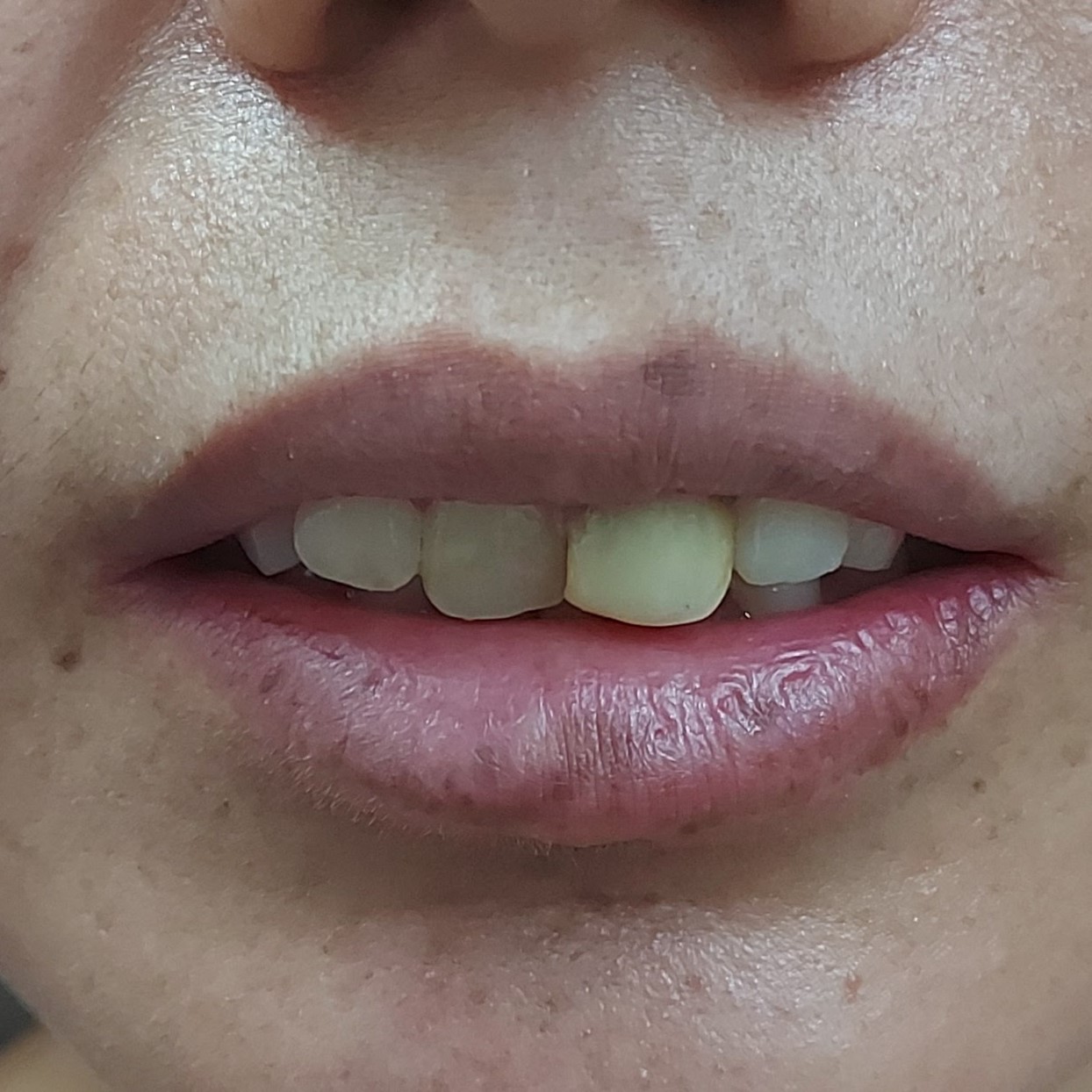 Before